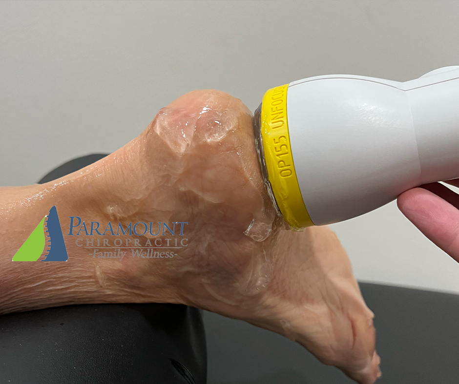 Discover Lasting Foot Pain Relief with SoftWave Tissue Regeneration Technology